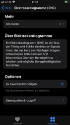 Herz Elektrokardiogramme (EKG).jpeg