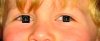 RedEye.jpg