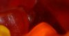 2010_01_01_Innervillgraten_350_2.JPG