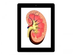 ipad2-kidney.jpg