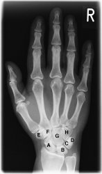 Xray_hand.jpg