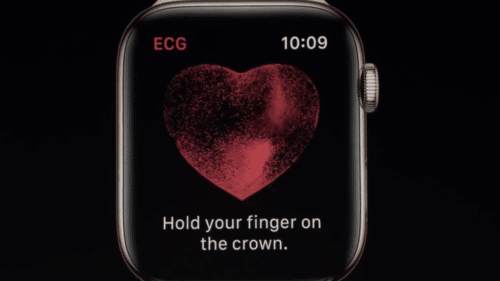 Apple-Watch-EKG--500x281.png