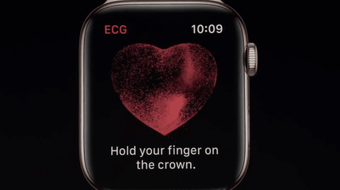 Apple-Watch-EKG--700x393.png