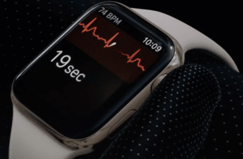 Apple-Watch-EKG-700x458-1-500x327.png