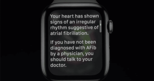 Apple-Watch-EKG-Herzrythmusstoerung-500x263.png