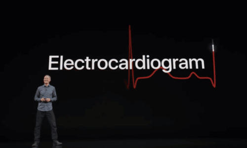 EKG-500x300.png