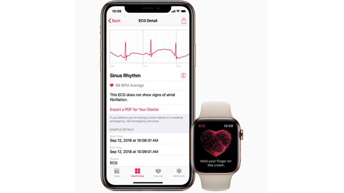 AliveCor