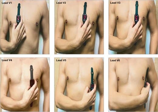 Foto: Texas Heart Institute Foto: Texas Heart Institute