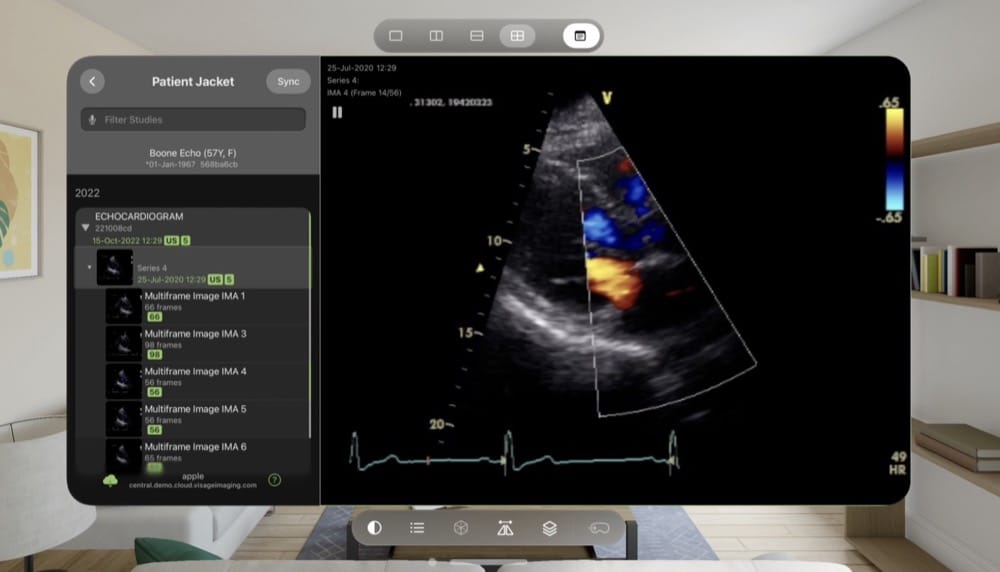 Gesundheitsbereich: Apple hebt Nutzung der Vision Pro hervor