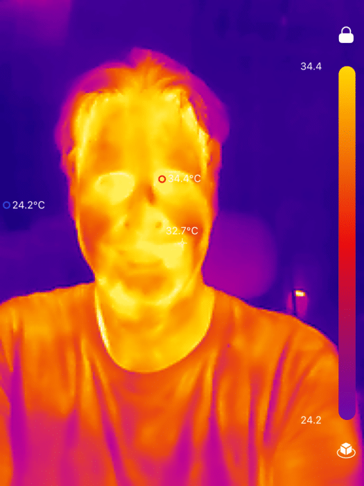 TopInfrared_1724069646306-525x700.png